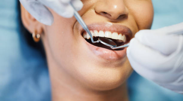 Best Lost Filling or Crown Replacement in Whiteville, NC